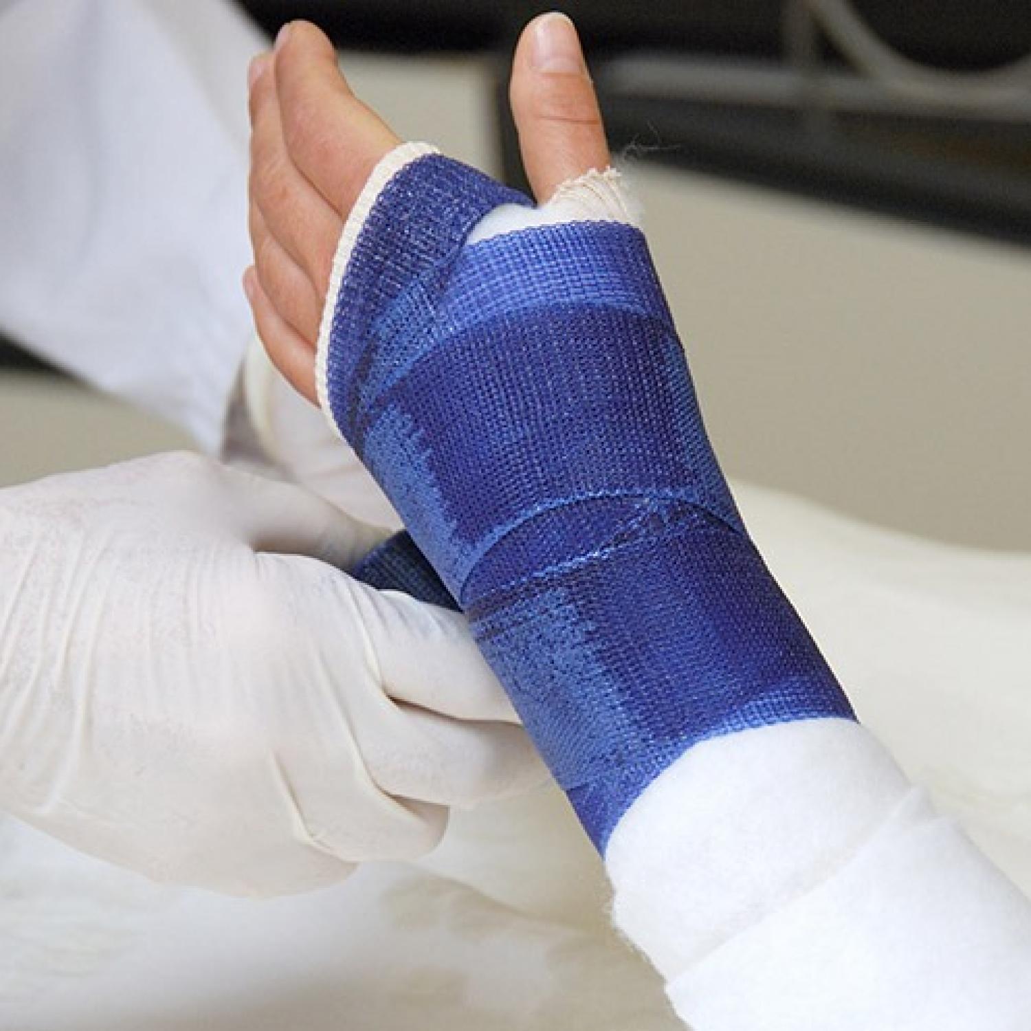 A person having a cast put on their arm