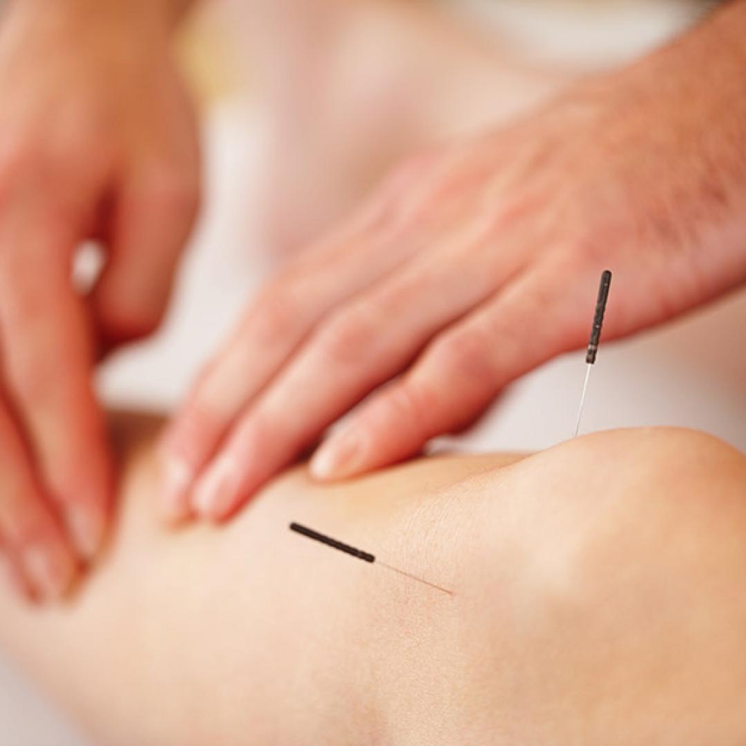 Acupuncturist Insurance, Get Your Quote Today Hiscox UK